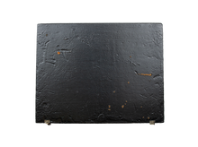 Load image into Gallery viewer, Trephination Set by Tiemann