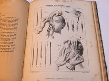 Load image into Gallery viewer, Atlas to Operative Surgery 1851