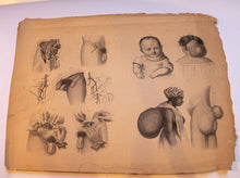 Load image into Gallery viewer, Atlas to Operative Surgery 1851