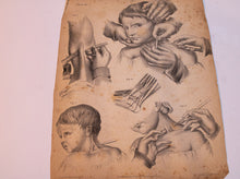 Load image into Gallery viewer, Atlas to Operative Surgery 1851