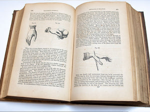 A System of Practical Surgery by William Ferguson,  2nd American Edition 1845