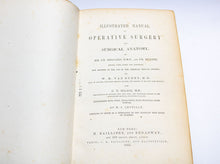 Load image into Gallery viewer, Bernard &amp; Huette Manual of Operative Surgery. 1855
