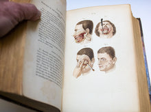 Load image into Gallery viewer, Bernard &amp; Huette Manual of Operative Surgery. 1855
