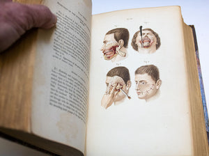 Bernard & Huette Manual of Operative Surgery. 1855