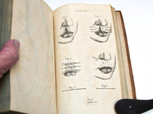Load image into Gallery viewer, A System of Surgery by Benjamin Bell. 1801
