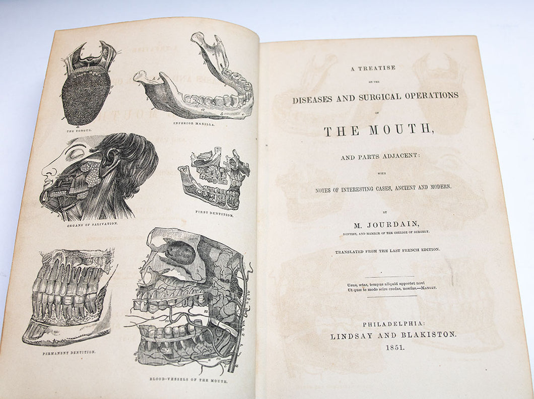 Diseases and Surgical Operations of the Mouth by Jourdain. 1851