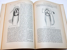 Load image into Gallery viewer, Excisions and Resections by John Ashhurst Jr. A rebound publication written by Ashhurst in the International Encyclopedia of Surgery. 1884.
