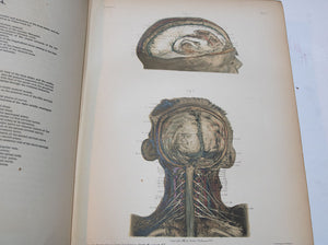 Large Two Vol. Set of McClellan"s Regional Anatomy 1892