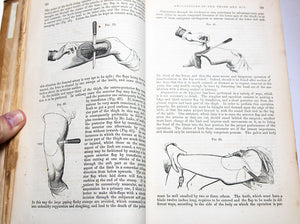 The Science and Art of Surgery by John Erichsen. Circa 1860.